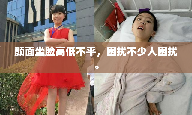颜面坐脸高低不平，困扰不少人困扰。