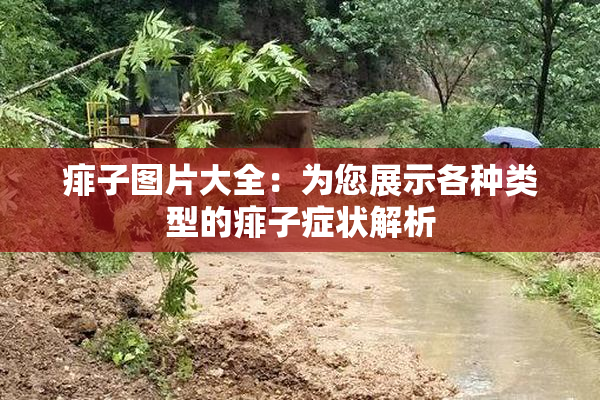 痱子图片大全：为您展示各种类型的痱子症状解析