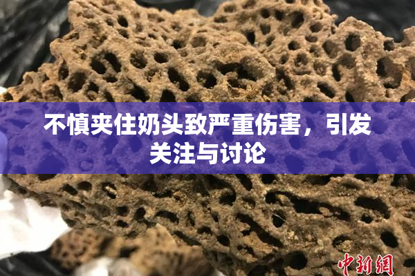 不慎夹住奶头致严重伤害，引发关注与讨论
