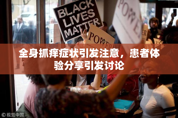 全身抓痒症状引发注意，患者体验分享引发讨论
