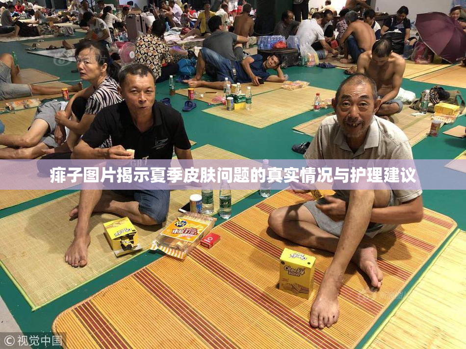 痱子图片揭示夏季皮肤问题的真实情况与护理建议