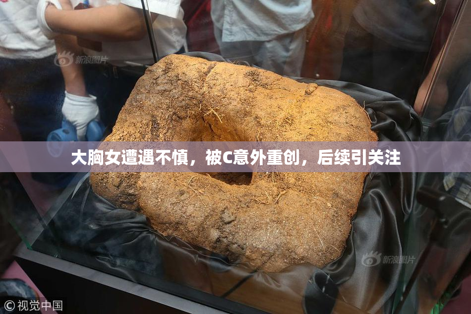 大胸女遭遇不慎，被C意外重创，后续引关注