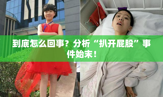 到底怎么回事？分析“扒开屁股”事件始末！