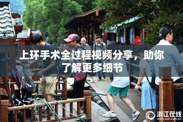 上环手术全过程视频分享，助你了解更多细节