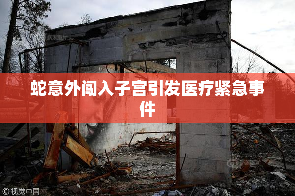 蛇意外闯入子宫引发医疗紧急事件