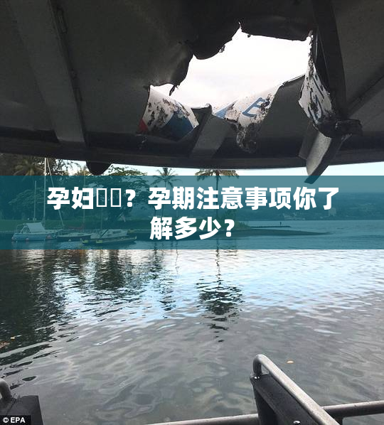 孕妇乂乄？孕期注意事项你了解多少？