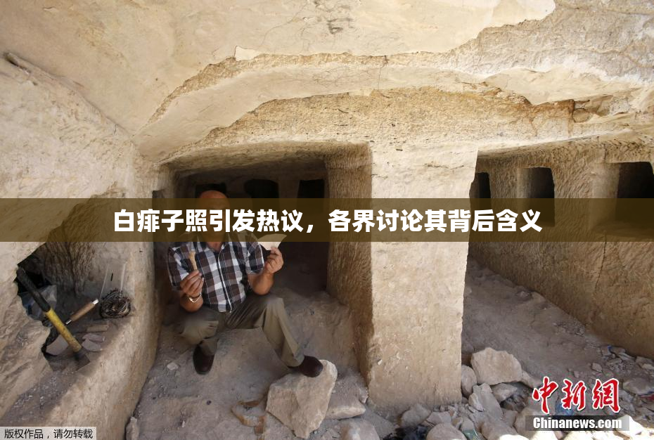 白痱子照引发热议，各界讨论其背后含义