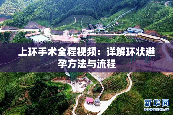 上环手术全程视频：详解环状避孕方法与流程