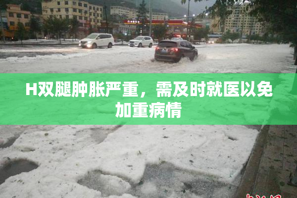 H双腿肿胀严重，需及时就医以免加重病情