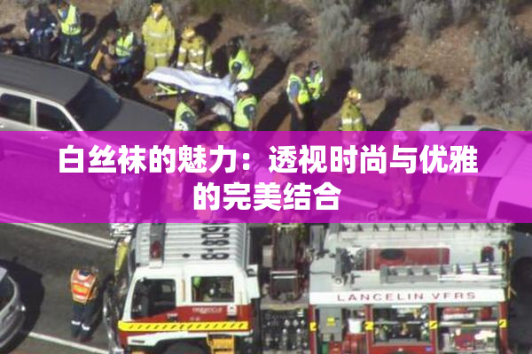 白丝袜的魅力：透视时尚与优雅的完美结合
