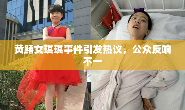 黄鳝女琪琪事件引发热议，公众反响不一