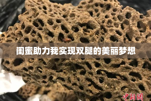闺蜜助力我实现双腿的美丽梦想