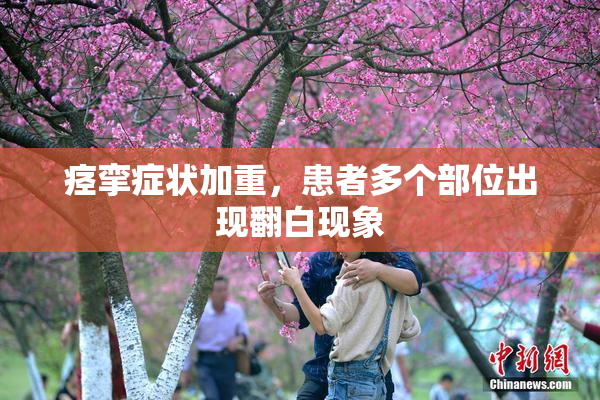 痉挛症状加重，患者多个部位出现翻白现象